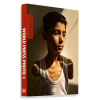 The book cover for World Press Photo 2025. The cover features a photograph of a young boy with amputated arms wearing a white tank top. He stands against a wall, his face and body partially lit by a strong, warm light that casts a deep shadow. He looks to the side with a pensive expression.